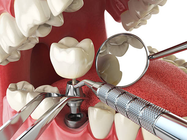Best Tooth Pain Emergency Relief  in High Rolls, NM